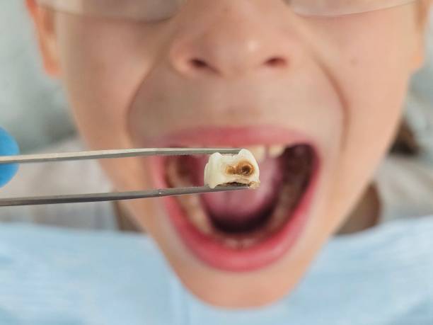 Best Broken Tooth Emergency  in North Ogden, UT